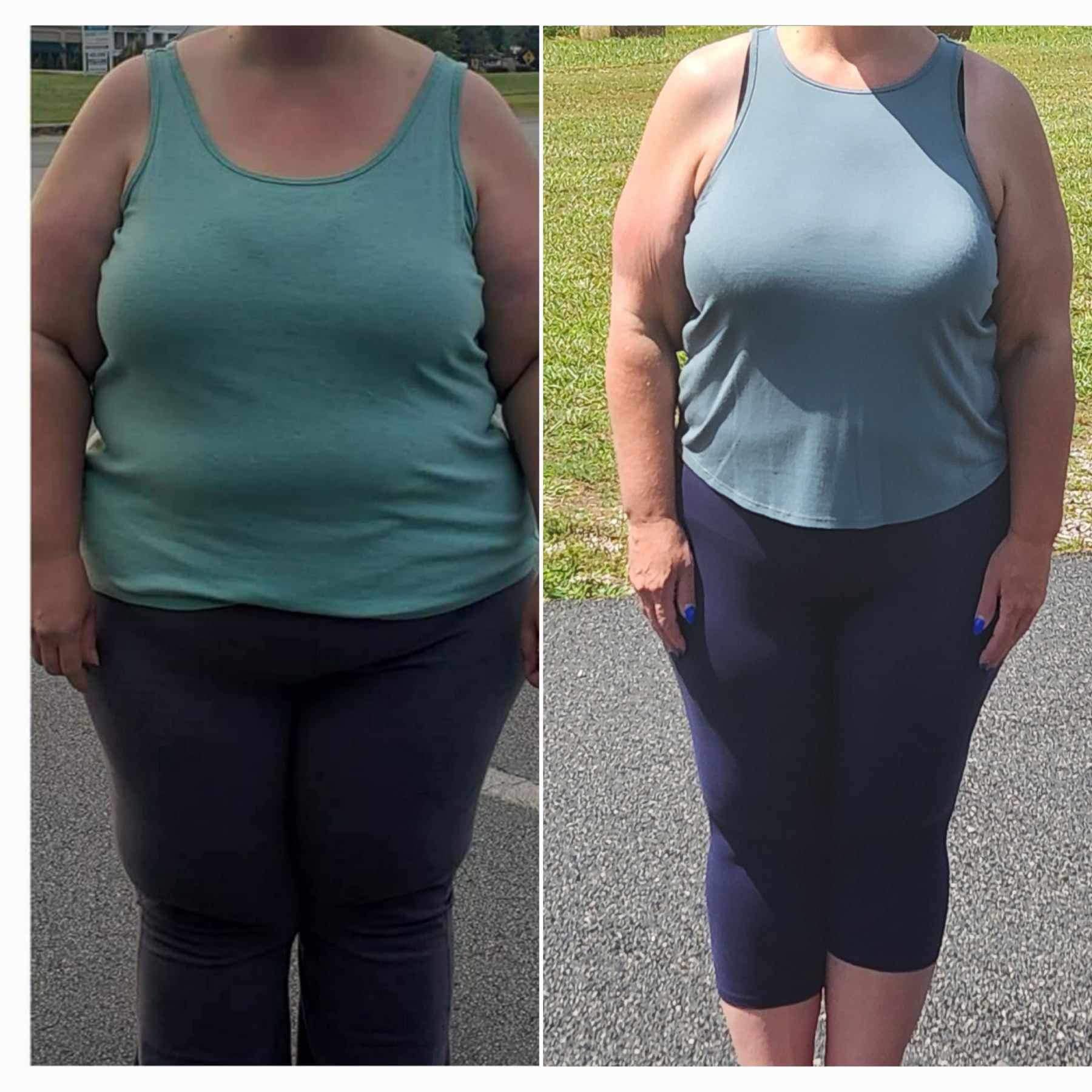 Before and after weight loss images of a woman